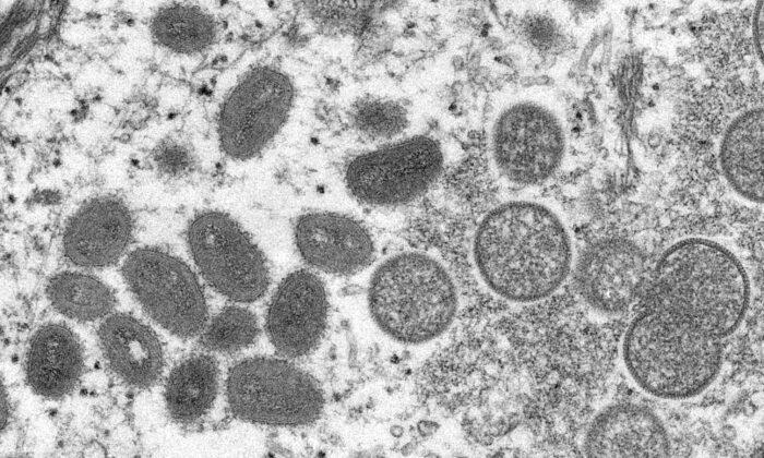 Зрелые овальные частицы вируса оспы обезьян, а также полумесяцы и сферические частицы незрелых вирионов, полученные из клинического образца кожи заражённого человека, 18 мая 2022 года. Фото: Cynthia S. Goldsmith, Russell Regnery/CDC/Handout via Reuters
 | Epoch Times Media