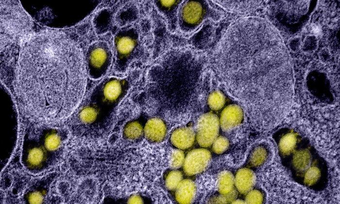 Электронная микрофотография частиц вируса SARS-CoV-2. Фото: NIAID
 | Epoch Times Media