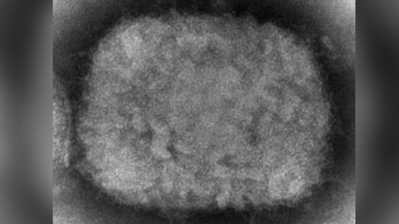 Вирион оспы обезьян, полученный из клинического образца в 2003 году на электронно-микроскопическом изображении. Фото: Cynthia S. Goldsmith/CDC | Epoch Times Media