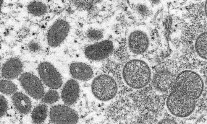 Зрелые овальные вирионы оспы обезьян (слева) и сферические незрелые вирионы, полученные из образца кожи человека, связанного со вспышкой луговых собачек в 2003 году. Фото: Cynthia S. Goldsmith, Russell Regner/CDC via AP
 | Epoch Times Media